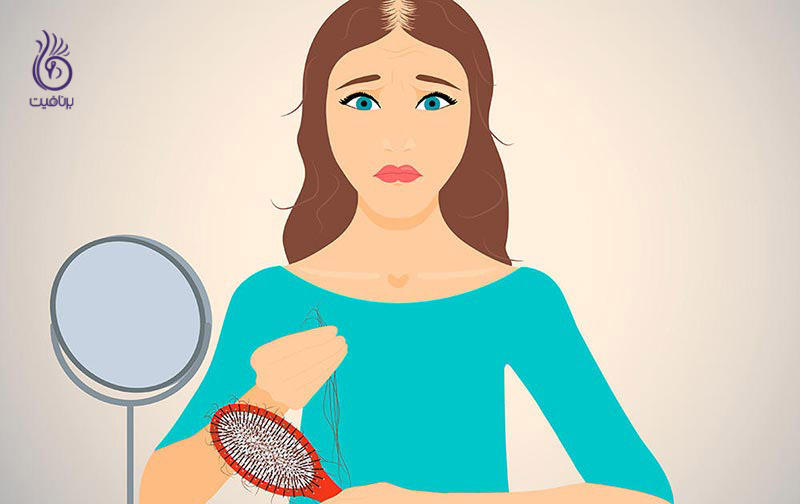 از آلوپسی چه می دانید؟