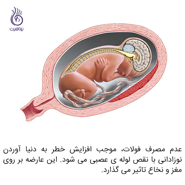 مکمل های فولیک اسید در دوران بارداری - جنین - برنافیت