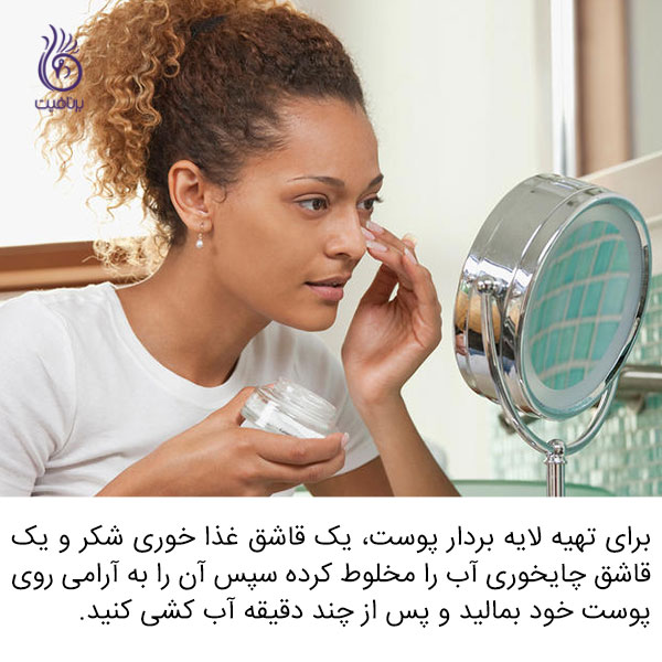 درمان خانگی برای مشکلات پوستی - لایه بردار - برنافیت