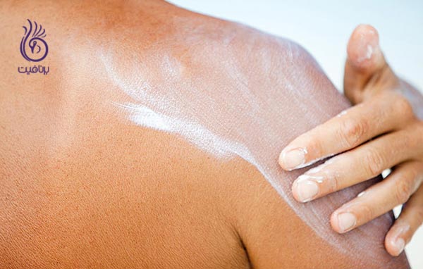 سرطان پوست - ضد آفتاب - برنافیت