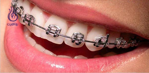 این 7 قدم دندان های شما را زیباتر می کنند - برنافیت