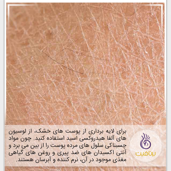 روش های لایه برداری از پوست های مختلف - برنافیت