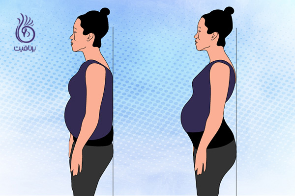 دوره بارداری - حرکات ورزشی - برنافیت