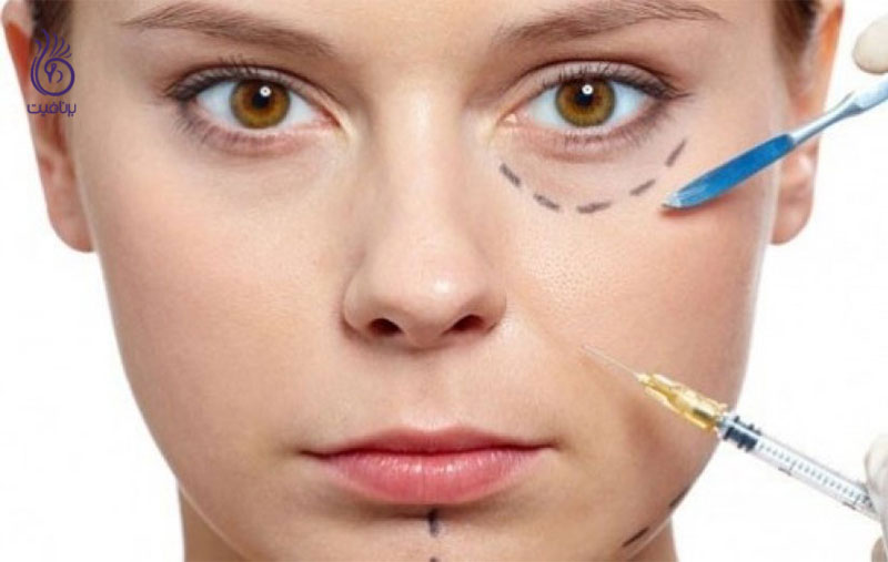 تزریق ژل- زیبایی- برنافیت