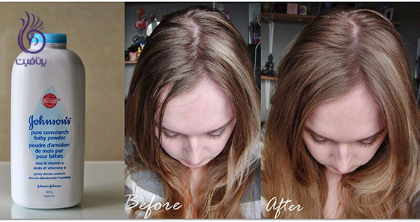 درمان موی چرب- پودر بچه- برنافیت