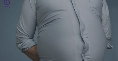 چاقی شکم- برنافیت