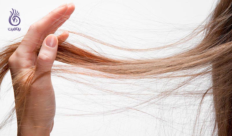 چگونه بیماری لایم موجب ریزش موها می شود؟