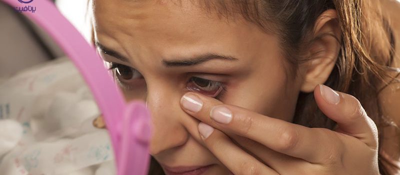 چرا دچار حساسیت پوستی می شوید؟